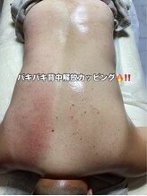 シャイニースキン(Shiny skin)/背中のバキバキから解放へ