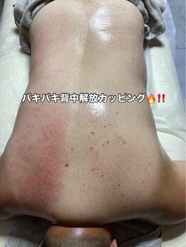 シャイニースキン(Shiny skin)/背中のバキバキから解放へ