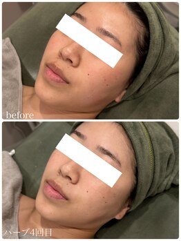 クラン 森ノ宮店(Clan)/20代女性