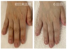キレイテ 上野店/50代/6回目【ハンドケア上野】