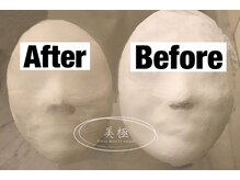 美極 トータルビューティー(美極 TOTAL BEAUTY)/恵比寿/小顔コルギ/エステ/