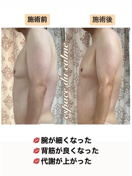 カルマーアンドビー(Calmer & Be.)/【メンズ痩身】Before/After