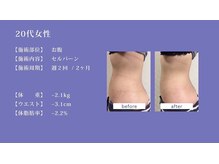 マルク(MARQUE)/夏までにくびれたウエスト!!