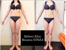レナトゥス 銀座(Renatus)の雰囲気（【集中美脚ケア】2ヶ月でむくみ＆セル肉解消！ほっそり美脚に♪）