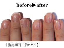 リング ザ ベル(ring the bell)/深爪・育爪専門コース