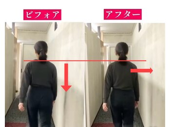 距骨サロン 岡山店)/肩こり&股関の痛みが楽に♪