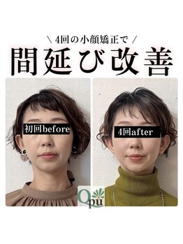 キュープ 富士店(Qpu)/年々お顔が大きくなっている、、