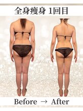 ドレス(dress)/全身痩身Before/After
