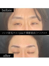 ユー 千葉駅前店(you)/ビフォ－アフター写真