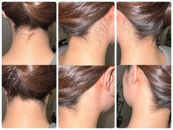 ワイズサロン(Y's salon)/うなじ脱毛