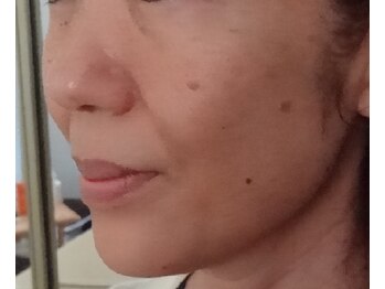 ミルフォイル(Milfoil)/維持力のあるタルミケアB