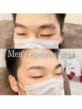 ソラ(sora)/ビフォーアフター