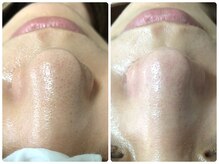 リュミエール(lash&brow lumiere)/鼻wax