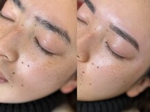 リンクビーワクシング(LINK B WAXING)/
