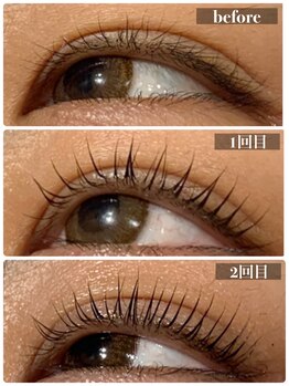 セレンディピティ(Serendipity)/マイラミネーション