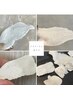 フェイシャルWAX脱毛☆
