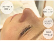 一つ一つ丁寧に毛穴詰まりを取り除き自身が持てる素肌美人へ