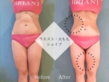 ピュアエステ ブリアント 松戸店/お客様の結果［松戸］