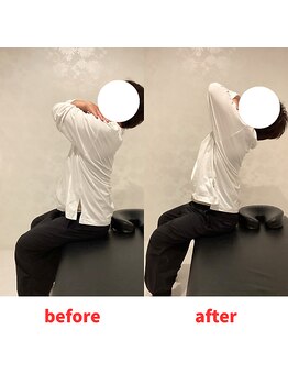 ナオル整体 福岡香椎院(NAORU整体)/30代男性施術事例　背骨の柔軟性