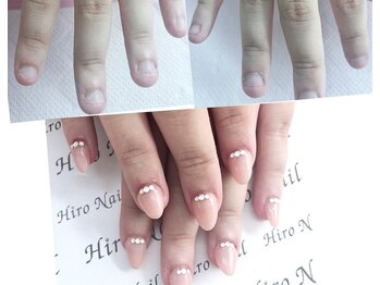 ヒロネイル(Hiro Nail)の写真/【深爪でお悩みの方へ◎】スカルプチュアで長さ出し矯正！思わず見惚れるナチュラル自爪風の美しい指先に♪