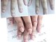 ヒロネイル(Hiro Nail)の写真/【深爪でお悩みの方へ◎】スカルプチュアで長さ出し矯正！思わず見惚れるナチュラル自爪風の美しい指先に♪