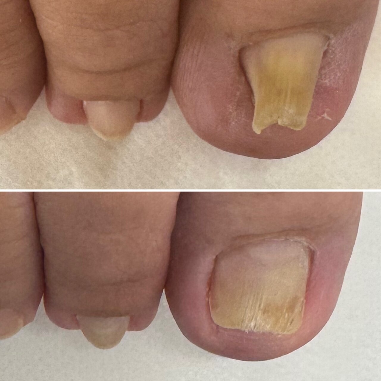 徳島県でフットケアが人気のネイルサロン｜ホットペッパービューティー