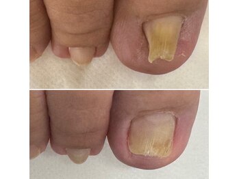 なかやまネイルクリニック