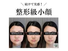 キュープ 広島店(Qpu)の雰囲気（回数を重ねる毎にお顔が整い変化します!）