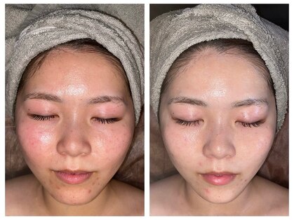 ブレアドール(Blair-Doll)の写真