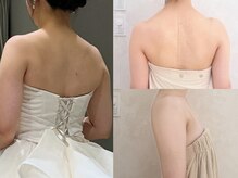 カレンジェビューティー(CarengeBeauty)/ブライダル痩身