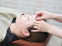 ジョイプラス川西鍼灸整骨院(joyplus.川西鍼灸整骨院)