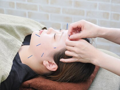 ジョイプラス川西鍼灸整骨院(joyplus.川西鍼灸整骨院)の写真