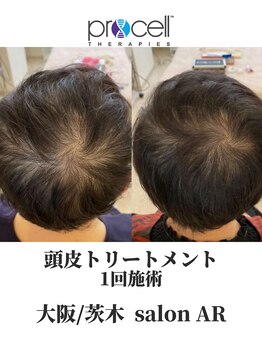 サロン アール(salon AR)/プロセルセラピーズ