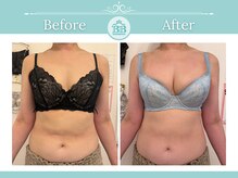 美人バスト 浦和店/【バストアップ★育乳】症例