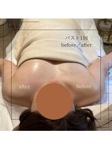 ラ ヴィレ ボーテ(La vraie beaute’)/バストケア before/after