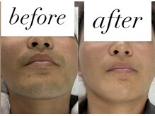 フェリス(FELIZ)/別人級の美肌