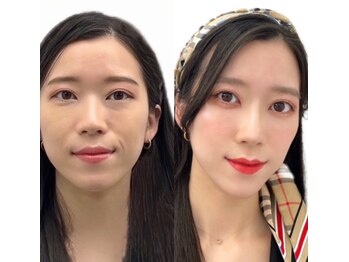 メゾンカラクル/メイクビフォーアフター