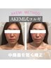  9月限定**華奢魅せデコルテ*小顔＆首肩こり撃退70分¥5000※カウンセリング込