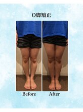 コア カイロプラクティック 錦糸町/ビフォーアフター　錦糸町/亀戸