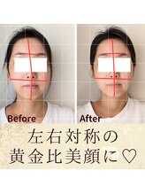 スウ(suu.)/Before-After【30代】12 回