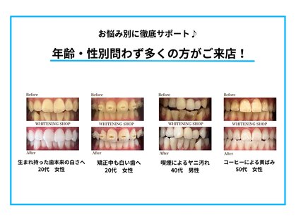 ホワイトニングショップ 熊谷店の写真