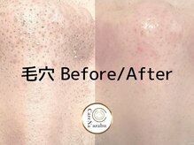 CareNa 浅草橋店の雰囲気（施術のBefore/Afterはブログやフォトギャラリーをご覧ください。）