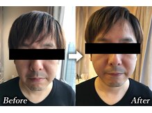 トランザット 代官山(TransATT)/顔の引き締めで印象が激変