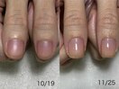 3ヶ月最強ネイルケア8回コース