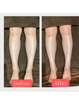 グロウ トータルビューティデザイン(GLOW TOTAL BEAUTY DESIGN)/オイルフットケア