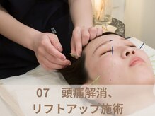 オムリス鍼灸接骨院/美容鍼の流れ　オムリス/駒込店