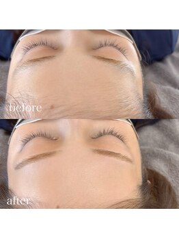 ルブール(levure)/おでこWAXで女性らしい丸みを