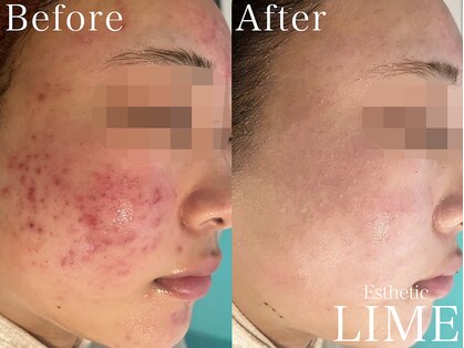 ライム 渋谷(LIME)の写真