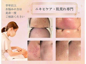 リシェル(Richelle)