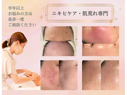 リシェル(Richelle)の写真